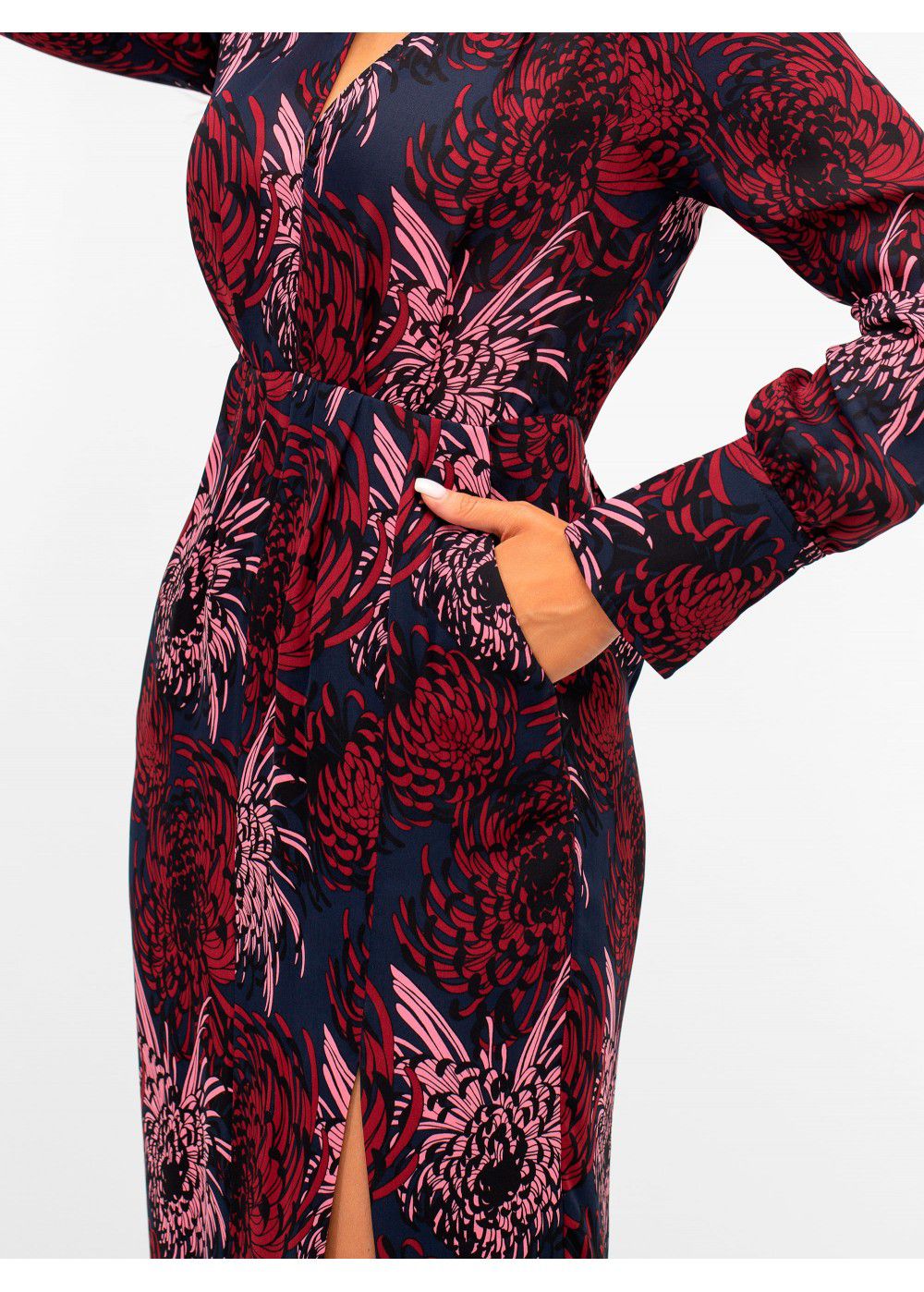 A.L.C. Bailey Dress